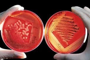 06-27_dia-mundial-microbioma